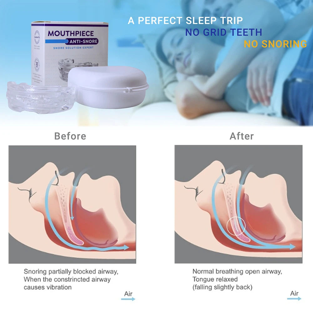 SnoreGuard Mouthpiece ®Anti-Snore Mouth Guard for Teeth Grinding and Better Sleep